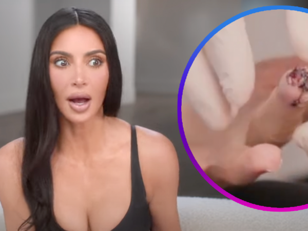 Kim Kardashian Slices Part of Her Finger Off, Says It Was ‘More Painful Than Childbirth’
