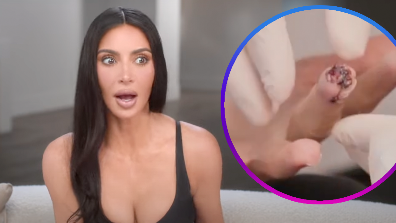 Kim Kardashian Slices Part of Her Finger Off, Says It Was ‘More Painful Than Childbirth’ Kim Kardashian Slices Part of Her Finger Off, Says It Was ‘More Painful Than Childbirth’