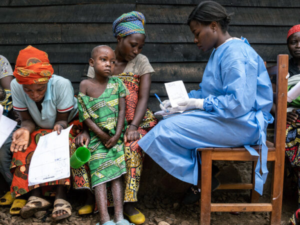 Battling Mpox in the Outbreak’s Epicenter in Congo Battling Mpox in the Outbreak’s Epicenter in Congo