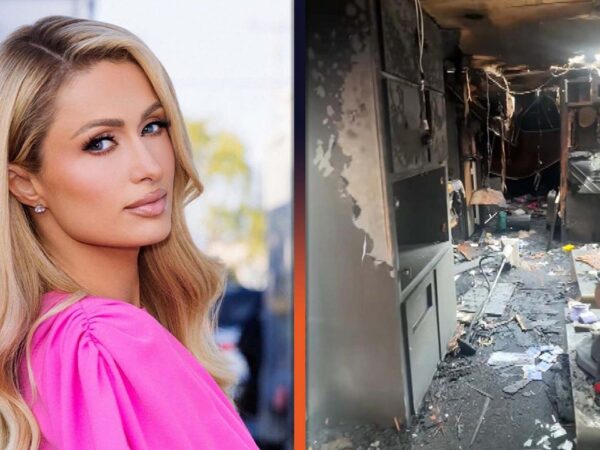 Paris Hilton Documents Shocking Damage From Music Video Set Fire