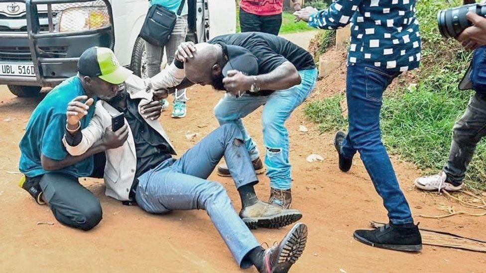Uganda’s Bobi Wine injured by policeman Uganda’s Bobi Wine injured by policeman