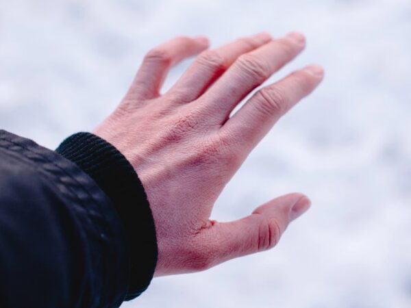 Do wind chill temperatures affect your frostbite chances?